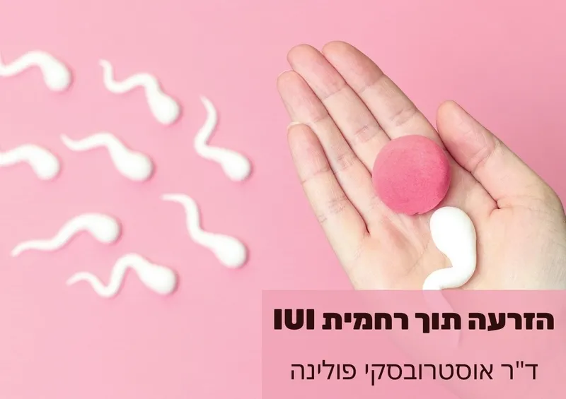 ד"ר אוסטרובסקי פולינה - הזרעה תוך רחמית IUI